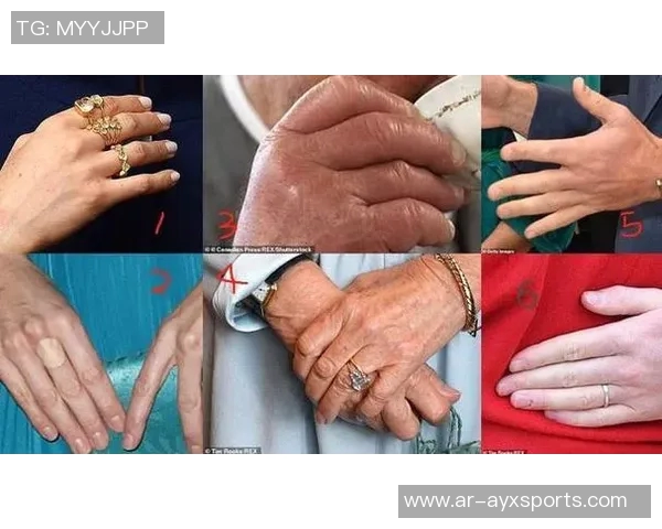 查尔斯李宣布克尼佩尔脚踝扭伤确诊状态每日观察中